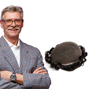 How Common Is Hair Loss, And What Are Your Options?